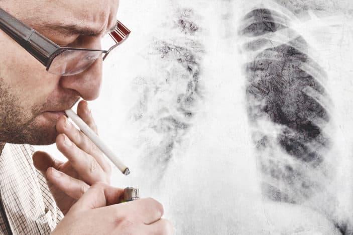 príznaky rakoviny pľúc