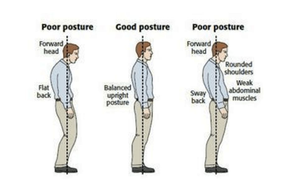Zdroj obrázku: http://www.thephysiocompany.com/blog/stop-slouching-postural-dysfunction-symptoms-causes-and-treatment-of-bad-posture