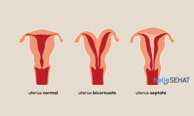 abnormality v maternici
