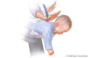 Kroky, ktoré pomôžu uškodiť deťom (1-3) zdroje: www.webmd.com