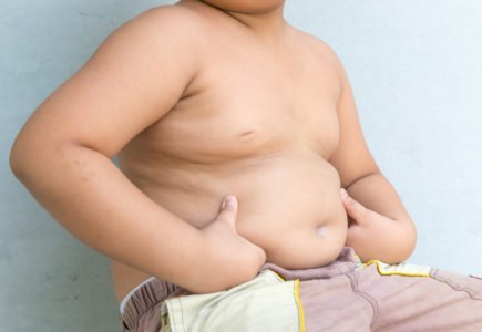 obezita u detí