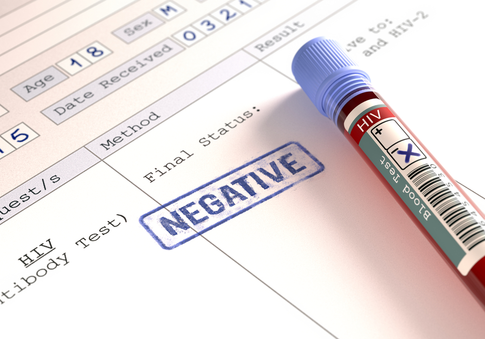 význam negatívnych výsledkov testov na HIV