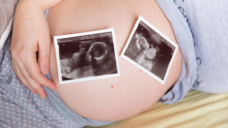riziko otehotnenia dvojčatami zmizne
