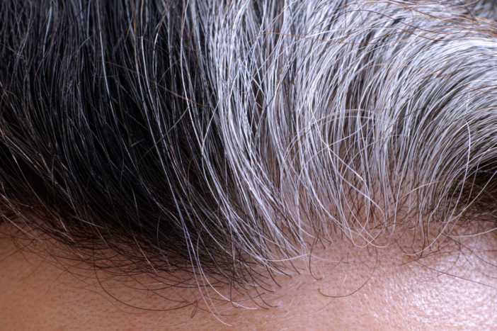 príčiny sivých vlasov