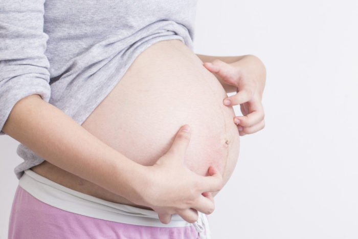 Svrbená folikulitída je príčinou svrbiacej kože počas tehotenstva