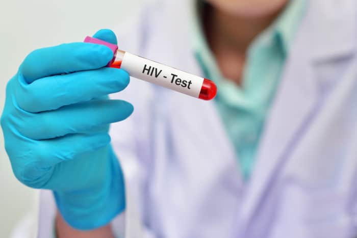 Krvný test HIV