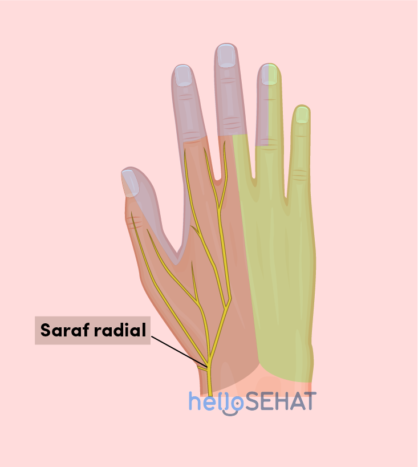 obraz ruky - radiálny nerv